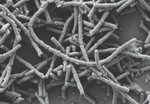 L. Crispatus from a microscopic image